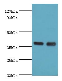 CD1A Antibody - Western blot. All lanes: CD1A antibody at 6 ug/ml. Lane 1: k562 whole cell lysate. Lane 2: mouse thymus. Secondary antibody: Goat polyclonal to rabbit at 1:10000 dilution. Predicted band size: 37 kDa. Observed band size: 37 kDa.