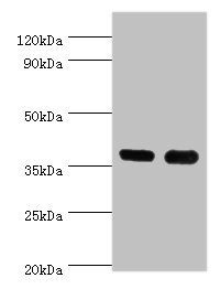 CD1A Antibody - Western blot All lanes: CD1A antibody at 6µg/ml Lane 1: K562 whole cell lysate Lane 2: Mouse thymus tissue Secondary Goat polyclonal to rabbit IgG at 1/10000 dilution Predicted band size: 37 kDa Observed band size: 37 kDa