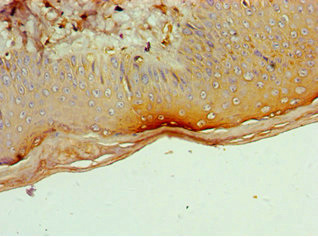 CD1A Antibody - Immunohistochemistry of paraffin-embedded human skin tissue using CD1A Antibody at dilution of 1: 100