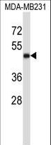 CD1A Antibody - CD1A Antibody western blot of MDA-MB231 cell line lysates (35 ug/lane). The CD1A antibody detected the CD1A protein (arrow).