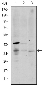 CD1A Antibody - Western blot using CD1A mouse monoclonal antibody against K562 (1), RAJI (2), and MOLT4 (3) cell lysate.
