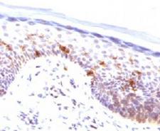 CD1A Antibody - IHC testing of human human skin stained with CD1a antibody (CLDA1a).  This image was taken for the unmodified form of this product. Other forms have not been tested.