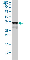 CD1A Antibody - CD1A monoclonal antibody (M01), clone M1-2-1B5 Western Blot analysis of CD1A expression in K-562.