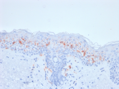 CD1A Antibody - Formalin-fixed, paraffin-embedded human Skin Stained with CD1a Mouse Recombinant Monoclonal Antibody (rC1A/711).