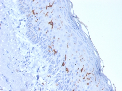 CD1A Antibody - Formalin-fixed, paraffin-embedded human Skin Stained with CD1a Mouse Recombinant Monoclonal Antibody (rC1A/711).