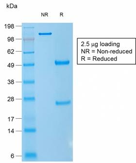CD1A Antibody - SDS-PAGE Analysis Purified CD1a Mouse Recombinant Monoclonal Antibody (rC1A/711). Confirmation of Purity and Integrity of Antibody.