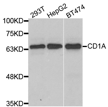 CD1A Antibody - Western blot analysis of extracts of various cell lines.