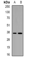CD1A Antibody - Western blot analysis of CD1a expression in HepG2 (A); BT474 (B) whole cell lysates.