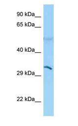CD1B Antibody - CD1B antibody Western Blot of MCF7.  This image was taken for the unconjugated form of this product. Other forms have not been tested.