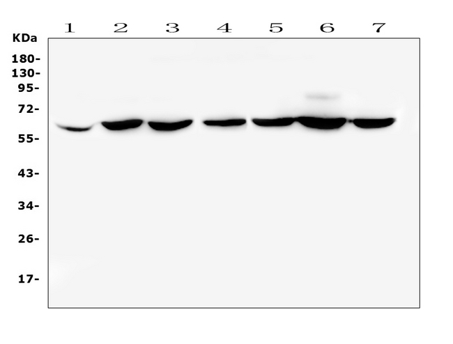 CD1B Antibody - Western blot analysis of CD1b using anti-CD1b antibody. Electrophoresis was performed on a 5-20% SDS-PAGE gel at 70V (Stacking gel) / 90V (Resolving gel) for 2-3 hours. The sample well of each lane was loaded with 50ug of sample under reducing conditions. Lane 1: human placenta tissue lysates,Lane 2: human PC-3 whole cell lysate,Lane 3: human SW620 whole cell lysate,Lane 4: human THP-1 whole cell lysate,Lane 5: human MDA-MB-231 whole cell lysate,Lane 6: human K562 whole cell lysate,Lane 7: human A431 whole cell lysate. After Electrophoresis, proteins were transferred to a Nitrocellulose membrane at 150mA for 50-90 minutes. Blocked the membrane with 5% Non-fat Milk/ TBS for 1.5 hour at RT. The membrane was incubated with rabbit anti-CD1b antigen affinity purified polyclonal antibody at 0.5 µg/mL overnight at 4°C, then washed with TBS-0.1% Tween 3 times with 5 minutes each and probed with a goat anti-rabbit IgG-HRP secondary antibody at a dilution of 1:10000 for 1.5 hour at RT. The signal is developed using an Enhanced Chemiluminescent detection (ECL) kit with Tanon 5200 system. A specific band was detected for CD1b at approximately 65KD. The expected band size for CD1b is at 37KD.
