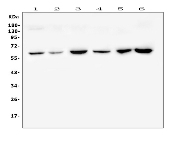 CD1B Antibody - Western blot analysis of CD1b using anti-CD1b antibody. Electrophoresis was performed on a 5-20% SDS-PAGE gel at 70V (Stacking gel) / 90V (Resolving gel) for 2-3 hours. The sample well of each lane was loaded with 50ug of sample under reducing conditions. Lane 1: rat brain tissue lysates,Lane 2: rat heart tissue lysates,Lane 3: rat lung tissue lysates,Lane 4: mouse brain tissue lysates,Lane 5: mouse lung tissue lysates,Lane 6: mouse Neuro-2a whole cell lysate. After Electrophoresis, proteins were transferred to a Nitrocellulose membrane at 150mA for 50-90 minutes. Blocked the membrane with 5% Non-fat Milk/ TBS for 1.5 hour at RT. The membrane was incubated with rabbit anti-CD1b antigen affinity purified polyclonal antibody at 0.5 µg/mL overnight at 4°C, then washed with TBS-0.1% Tween 3 times with 5 minutes each and probed with a goat anti-rabbit IgG-HRP secondary antibody at a dilution of 1:10000 for 1.5 hour at RT. The signal is developed using an Enhanced Chemiluminescent detection (ECL) kit with Tanon 5200 system. A specific band was detected for CD1b at approximately 65KD. The expected band size for CD1b is at 37KD.
