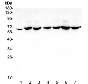 CD1B Antibody - Western blot testing of human 1) placenta, 2) PC-3, 3) SW620, 4) THP-1, 5) MDA-MB-231, 6) K562 and 7) A431 lysate with CD1b antibody at 0.5ug/ml. The predicted molecular weight is ~37 kDa but is often observed higher due to glycosylation.