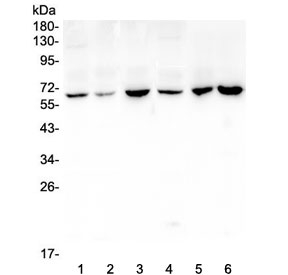 CD1B Antibody - Western blot testing of 1) rat brain, 2) rat heart, 3) rat lung, 4) mouse brain, 5) mouse lung and 6) mouse Neuro-2a lysate with CD1b antibody at 0.5ug/ml. The predicted molecular weight is ~37 kDa but is often observed higher due to glycosylation.