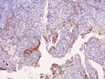 CD1B Antibody - IHC staining of FFPE human tonsil tissue with CD1b antibody at 1ug/ml. HIER: boil tissue sections in pH6, 10mM citrate buffer, for 10-20 min followed by cooling at RT for 20 min.