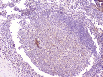 CD1B Antibody - IHC staining of FFPE human tonsil tissue with CD1b antibody at 1ug/ml. HIER: boil tissue sections in pH6, 10mM citrate buffer, for 10-20 min followed by cooling at RT for 20 min.