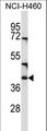 CD1C Antibody - CD1C Antibody western blot of NCI-H460 cell line lysates (35 ug/lane). The CD1C antibody detected the CD1C protein (arrow).