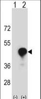CD1C Antibody - Western blot of CD1C (arrow) using rabbit polyclonal CD1C Antibody. 293 cell lysates (2 ug/lane) either nontransfected (Lane 1) or transiently transfected (Lane 2) with the CD1C gene.