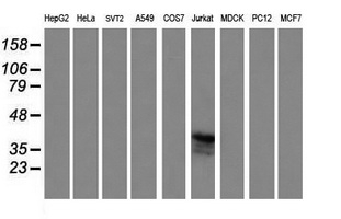 CD1C Antibody - Western blot of extracts (35 ug) from 9 different cell lines by using g anti-CD1C monoclonal antibody (HepG2: human; HeLa: human; SVT2: mouse; A549: human; COS7: monkey; Jurkat: human; MDCK: canine; PC12: rat; MCF7: human).