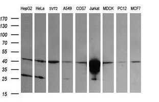 CD1C Antibody - Western blot of extracts (35 ug) from 9 different cell lines by using anti-CD1C monoclonal antibody (HepG2: human; HeLa: human; SVT2: mouse; A549: human; COS7: monkey; Jurkat: human; MDCK: canine; PC12: rat; MCF7: human).