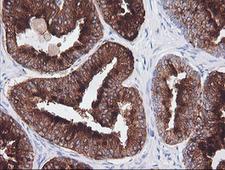 CD1C Antibody - IHC of paraffin-embedded Human prostate tissue using anti-CD1C mouse monoclonal antibody.
