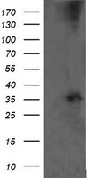 CD1C Antibody - HEK293T cells were transfected with the pCMV6-ENTRY control (Left lane) or pCMV6-ENTRY CD1C (Right lane) cDNA for 48 hrs and lysed. Equivalent amounts of cell lysates (5 ug per lane) were separated by SDS-PAGE and immunoblotted with anti-CD1C.