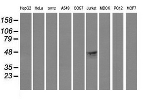 CD1C Antibody - Western blot of extracts (35ug) from 9 different cell lines by using anti-CD1C monoclonal antibody (HepG2: human; HeLa: human; SVT2: mouse; A549: human; COS7: monkey; Jurkat: human; MDCK: canine; PC12: rat; MCF7: human).