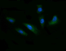 CD1C Antibody - Immunofluorescent staining of HeLa cells using anti-CD1C mouse monoclonal antibody.