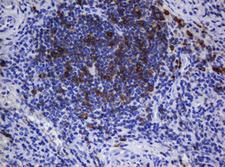 CD1C Antibody - IHC of paraffin-embedded Human lymph node tissue using anti-CD1C mouse monoclonal antibody. (Heat-induced epitope retrieval by 10mM citric buffer, pH6.0, 120°C for 3min).