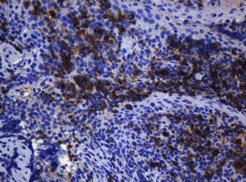 CD1C Antibody - IHC of paraffin-embedded Human tonsil using anti-CD1C mouse monoclonal antibody. (Heat-induced epitope retrieval by 10mM citric buffer, pH6.0, 120°C for 3min).