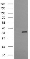 CD1C Antibody - HEK293T cells were transfected with the pCMV6-ENTRY control (Left lane) or pCMV6-ENTRY CD1C (Right lane) cDNA for 48 hrs and lysed. Equivalent amounts of cell lysates (5 ug per lane) were separated by SDS-PAGE and immunoblotted with anti-CD1C.