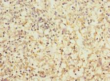 CD1C Antibody - Immunohistochemistry of paraffin-embedded human spleen tissue at dilution 1:100
