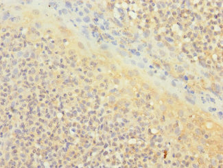 CD1C Antibody - Immunohistochemistry of paraffin-embedded human tonsil tissue at dilution 1:100