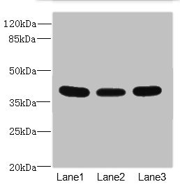CD1C Antibody - Western blot All Lanes: CD1C antibody at 3.89ug/ml Lane 1: HepG-2 whole cell lysate Lane 2: A549 whole cell lysate Lane 3: MCF7 whole cell lysate Secondary Goat polyclonal to rabbit IgG at 1/10000 dilution Predicted band size: 38 kDa Observed band size: 38 kDa