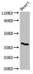 CD1C Antibody - Western Blot Positive WB detected in:Mouse heart tissue All Lanes:CD1C antibody at 3µg/ml Secondary Goat polyclonal to rabbit IgG at 1/50000 dilution Predicted band size: 38 KDa Observed band size: 38 KDa