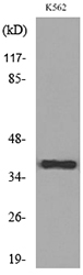CD1C Antibody - Western blot analysis of lysate from K562 cells, using CD1C Antibody.