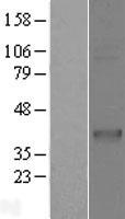 CD1C Protein - Western validation with an anti-DDK antibody * L: Control HEK293 lysate R: Over-expression lysate