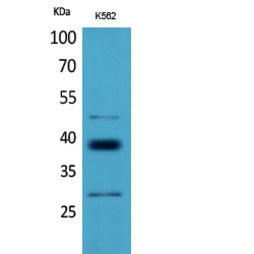 CD1D Antibody - Western blot of CD1D antibody