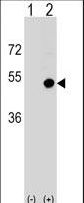 CD1D Antibody - Western blot of CD1D (arrow) using rabbit polyclonal CD1D Antibody. 293 cell lysates (2 ug/lane) either nontransfected (Lane 1) or transiently transfected (Lane 2) with the CD1D gene.
