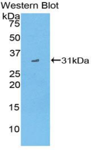 CD1D Antibody - Western blot of recombinant CD1D.  This image was taken for the unconjugated form of this product. Other forms have not been tested.