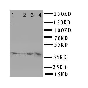 CD1D Antibody - WB of CD1D antibody. Lane 1: COLO320 Cell Lysate. Lane 2: HELA Cell Lysate. Lane 3: HT1080 Cell Lysate. Lane 4: JURKAT Cell Lysate.