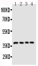 CD1D Antibody - Anti-CD1d antibody, Western blotting Lane 1: COLO320 Cell LysateLane 2: HELA Cell LysateLane 3: HT1080 Cell LysateLane 4: JURKAT Cell Lysate