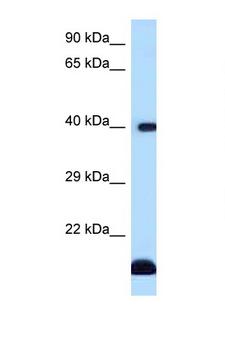 CD1D Antibody - CD1D antibody Western blot of Fetal Heart lysate. Antibody concentration 1 ug/ml.  This image was taken for the unconjugated form of this product. Other forms have not been tested.