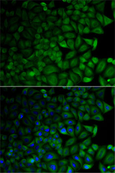 CD1D Antibody - Immunofluorescence analysis of HeLa cells using CD1D antibody. Blue: DAPI for nuclear staining.