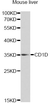 CD1D Antibody - Western blot analysis of extracts of mouse liver, using CD1D antibody at 1:1000 dilution. The secondary antibody used was an HRP Goat Anti-Rabbit IgG (H+L) at 1:10000 dilution. Lysates were loaded 25ug per lane and 3% nonfat dry milk in TBST was used for blocking.