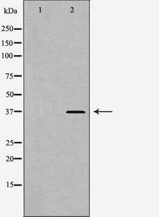 CD1D Antibody - Western blot analysis of HeLa whole cells lysates using CD1D antibody. The lane on the left is treated with the antigen-specific peptide.
