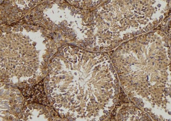 CD1D Antibody - 1:100 staining mouse testis tissue by IHC-P. The sample was formaldehyde fixed and a heat mediated antigen retrieval step in citrate buffer was performed. The sample was then blocked and incubated with the antibody for 1.5 hours at 22°C. An HRP conjugated goat anti-rabbit antibody was used as the secondary.