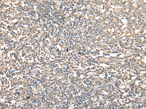 CD1D Antibody - Immunohistochemistry of paraffin-embedded Human tonsil tissue  using CD1D Polyclonal Antibody at dilution of 1:25(×200)