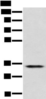 CD1D Antibody - Western blot analysis of Jurkat cell  using CD1D Polyclonal Antibody at dilution of 1:300