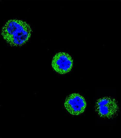 CD1E Antibody - Confocal immunofluorescence of CD1E Antibody with MDA-MB435 cell followed by Alexa Fluor 488-conjugated goat anti-rabbit lgG (green). DAPI was used to stain the cell nuclear (blue).