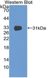 CD1E Antibody - Western blot of recombinant CD1E.